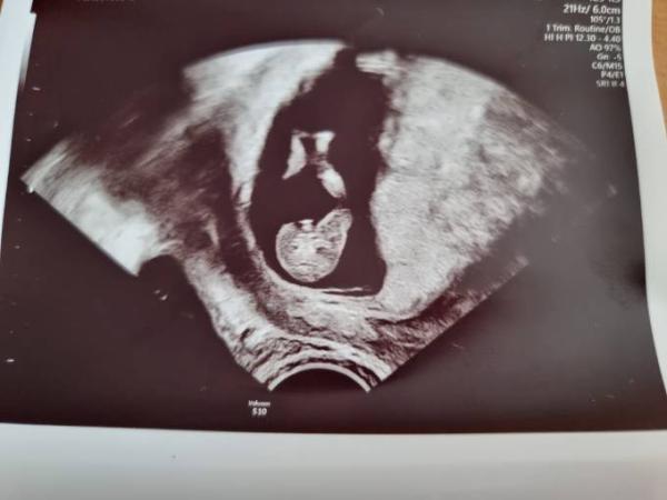 Bild zu Geschlecht :) - Forum für März - Mamis