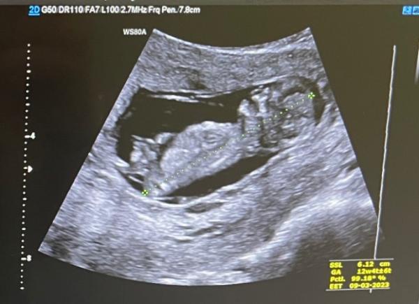 Bild zu Update - Forum für März - Mamis