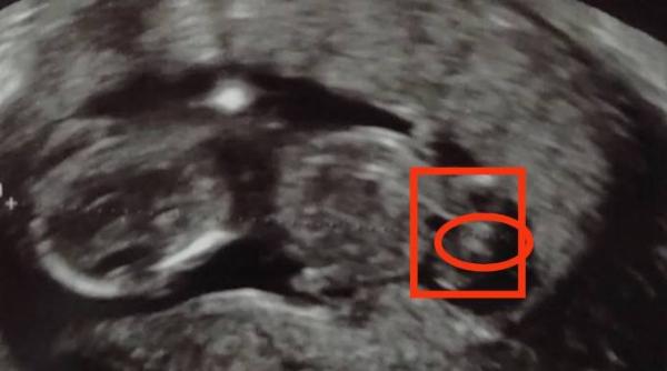 Bild zu Wir sind Team... - Forum für März - Mamis