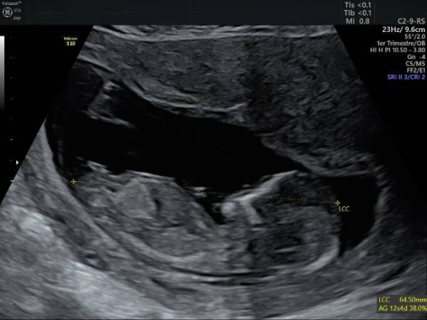 Bild zu Mädchen oder Junge ? :) - Forum für März - Mamis
