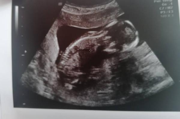 Bild zu Vu mit Tendenz zum Babyboy❤️ - Forum für März - Mamis