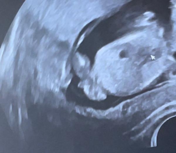 Bild zu Geschlecht ? - Forum für März - Mamis