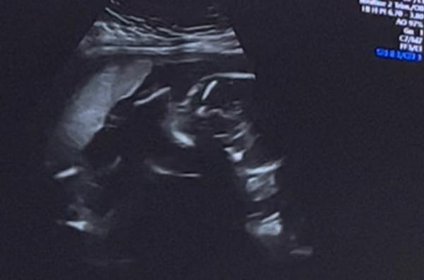 Bild zu Wir kommen vom ultraschall - Forum für März - Mamis