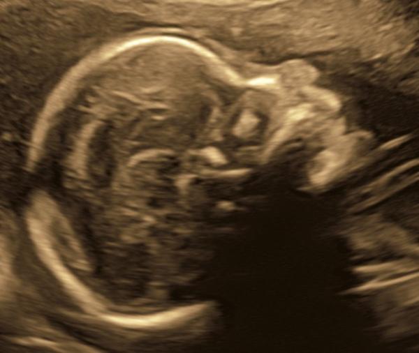Bild zu ebenfalls Update FD & OS 💖 - Forum für März - Mamis