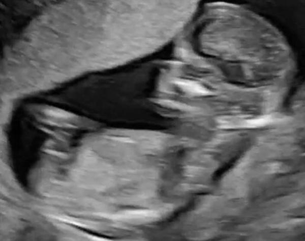 Bild zu Geschlecht? :) - Forum für März - Mamis