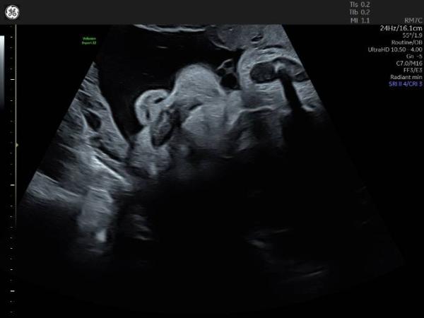 Bild zu Lustiges Foto - Forum für März - Mamis