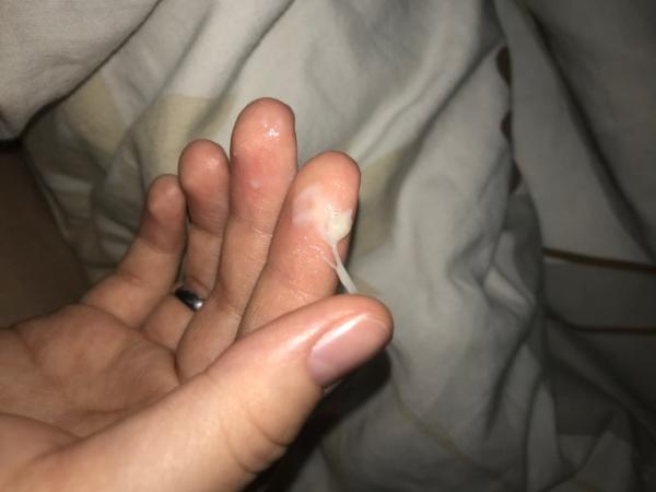 Bild zu Schleimpropf? (TW bild) - Forum für März - Mamis