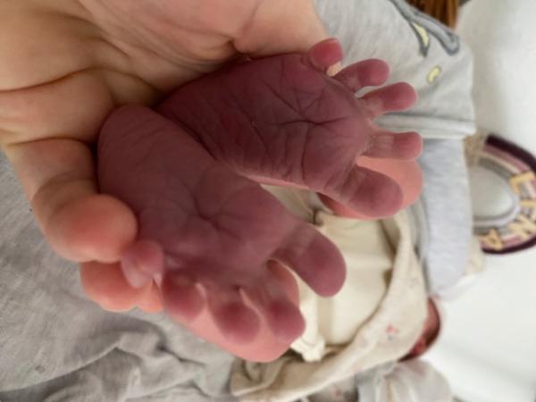 Bild zu Ausgekugelt- Geburtsbericht Hausgeburt bei ET+5 - Forum für März - Mamis