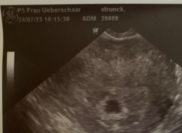 Bild zu Herztöne sind da - Forum für März - Mamis
