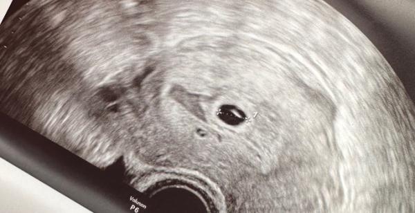 Bild zu Mein Wunderbaby - Forum für März - Mamis