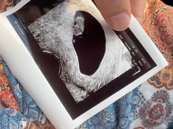 Bild zu Und jetzt? 1 FA Termin und gemischte Gefühle - Forum für März - Mamis