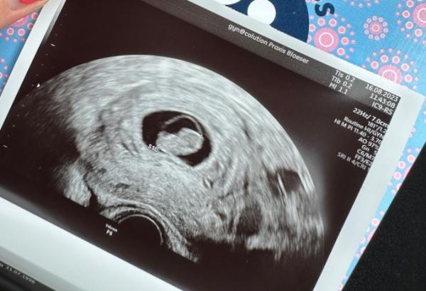 Bild zu Einfach sprachlos. - Forum für März - Mamis
