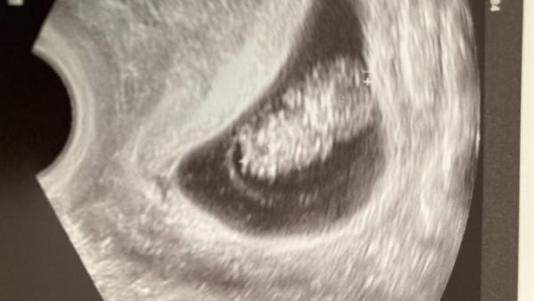 Bild zu Endlich, endlich… - Forum für März - Mamis