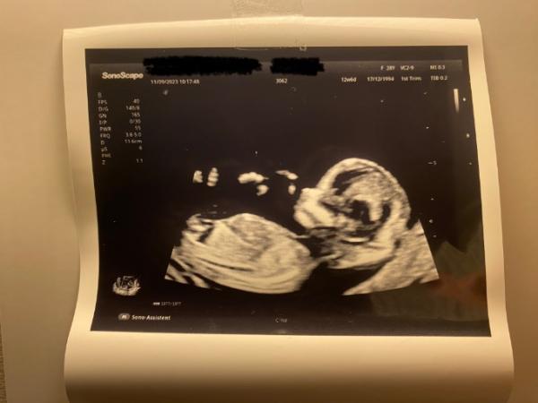 Bild zu Blutungen, US, Hebamme, Haushaltshilfe und Geburtshaus - Forum für März - Mamis