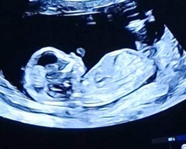Bild zu Mädchen oder Junge ? 🤰❤️ - Forum für März - Mamis