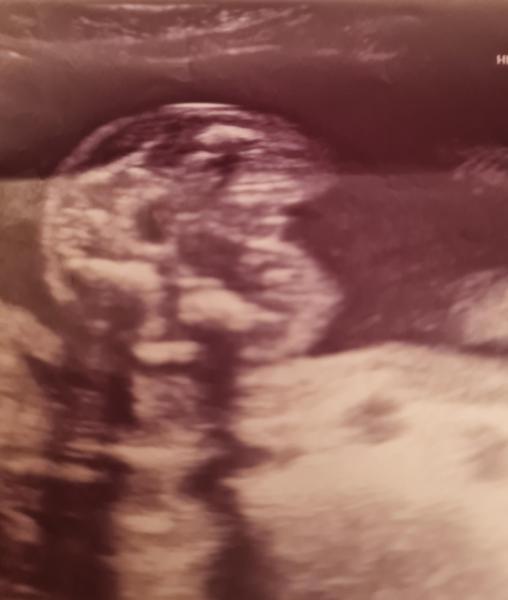 Bild zu Geschlecht Mädchen oder junge - Forum für März - Mamis