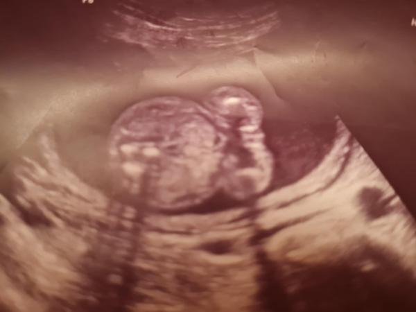 Bild zu Geschlecht Mädchen oder junge - Forum für März - Mamis