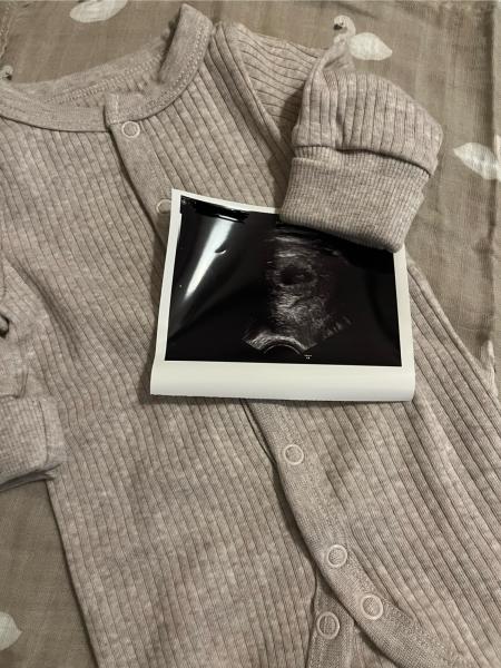 Bild zu 6+3 und das 🧡 blubbert 🥹 - Forum für März - Mamis