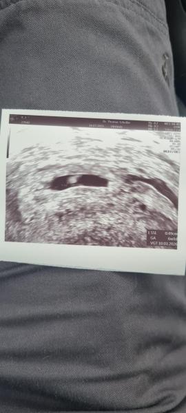 Bild zu 3. Baby gewollt aber nicht geplant - Forum für März - Mamis