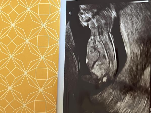 Bild zu Nub oder Bein? - Forum für März - Mamis