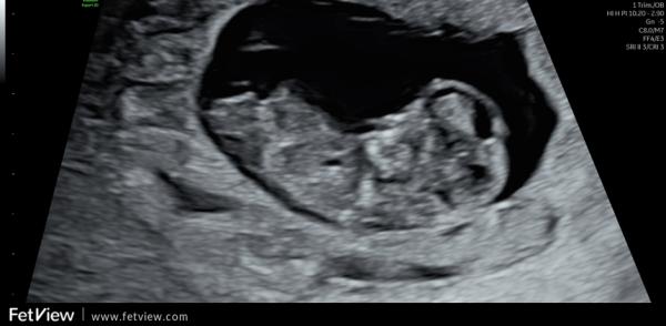Bild zu Nub-Theorie - Forum für März - Mamis