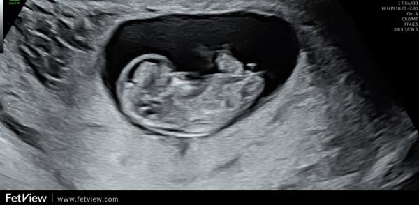 Bild zu Nub-Theorie - Forum für März - Mamis