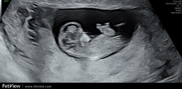 Bild zu Nub-Theorie - Forum für März - Mamis