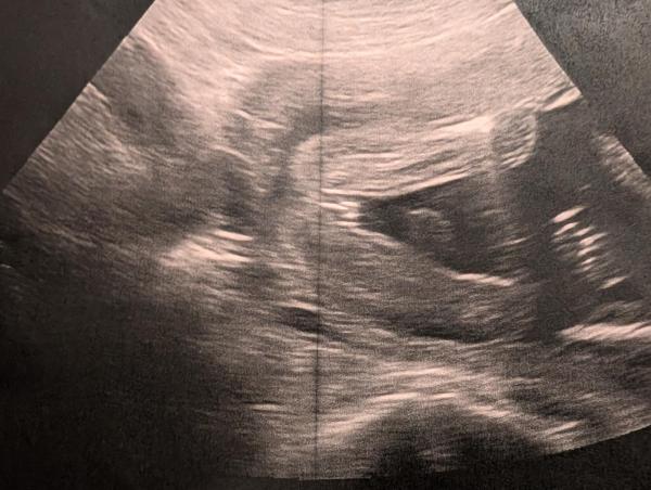 Bild zu Outing - bitte um Hilfe - Forum für März - Mamis