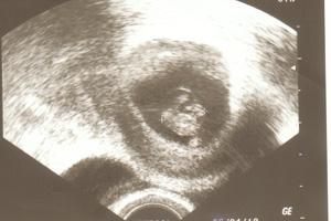 Bild zu Mein FA Bericht von gestern mit Bild - Forum für April - Mamis