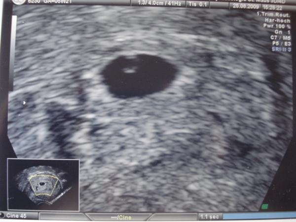 Bild zu Zurück vom FA! - Forum für April - Mamis