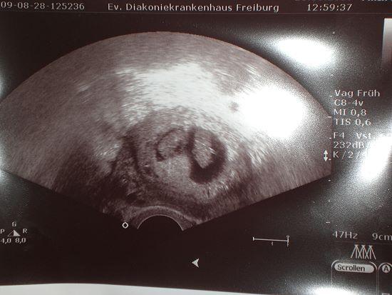 Bild zu Ich habe ein Bild - Forum für April - Mamis
