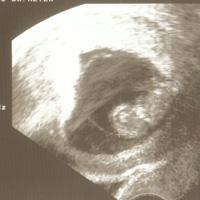 Bild zu Fa Bericht mit Bild - Forum für April - Mamis