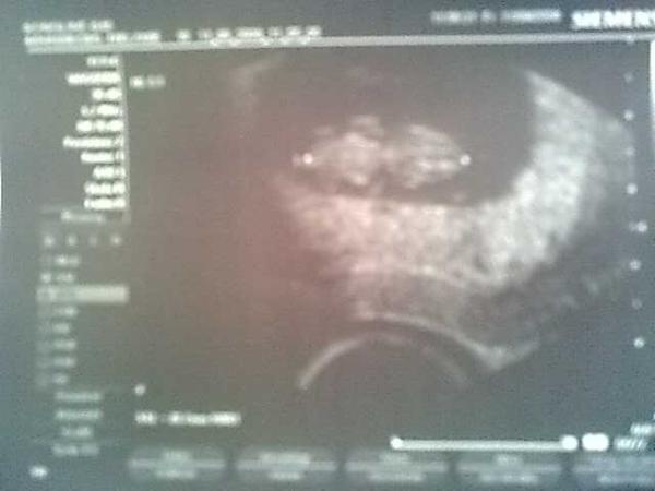 Bild zu 1. VU geschafft...happy! :-D - Forum für April - Mamis