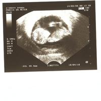 Bild zu Mein kleiner Wurm - Forum für April - Mamis