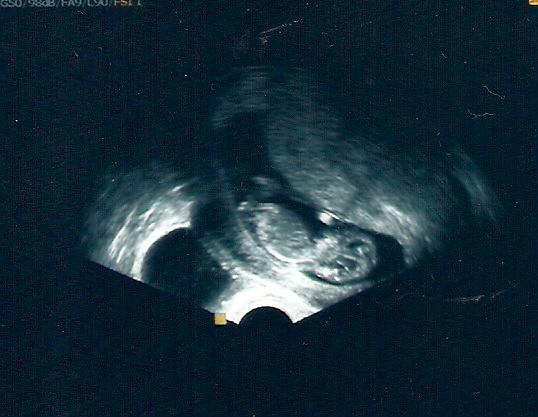 Bild zu Ein schickes Foto - Forum für April - Mamis