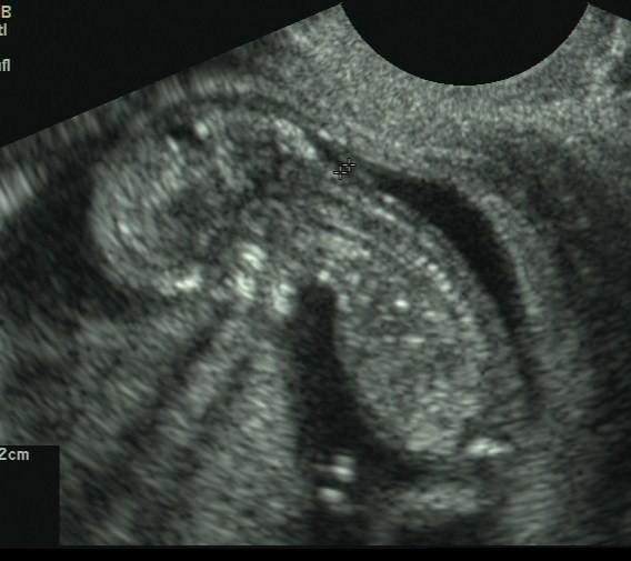 Bild zu Hier mein Baby ;-) - Forum für April - Mamis