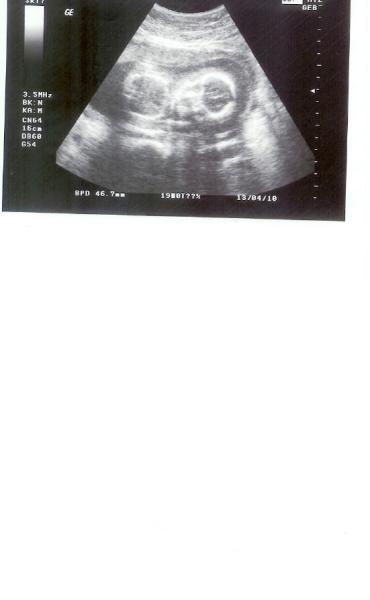 Bild zu So, hab jetzt auch mal ein Bildchen - Forum für April - Mamis
