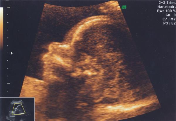 Bild zu Bild vom Sohnemann - Forum für April - Mamis