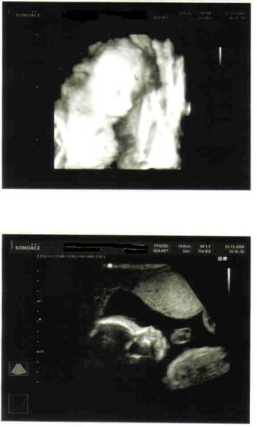 Bild zu Heute VU +  3D Bild - Forum für April - Mamis