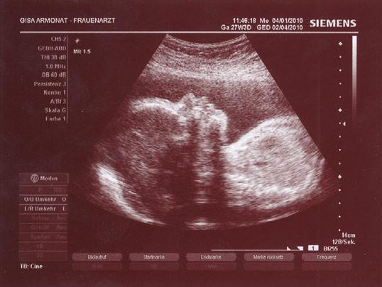 Bild zu Letztes Ultraschallbild vom Kleinen - Forum für April - Mamis