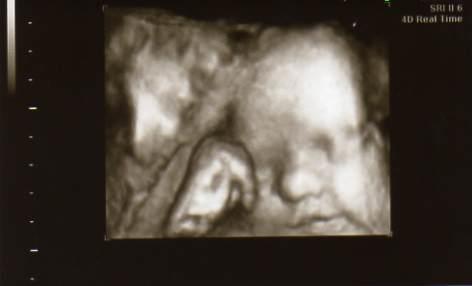 Bild zu 3D-Bilder vom letzten Freitag - Forum für April - Mamis