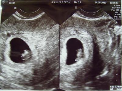 Bild zu @Kaka_b und maus05 und alle anderen zukünftigen April-Mamis :-) - Forum für April - Mamis