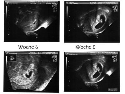 Bild zu Dar ich vorstellen "Krümel" ;-) - Forum für April - Mamis