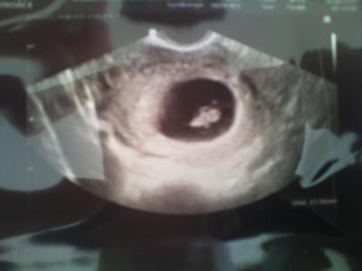 Bild zu mein baby - Forum für April - Mamis
