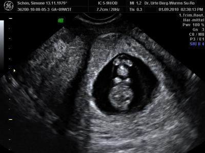 Bild zu Wir kriegen ein Gummibärchen...!!!!!!!!!! - Forum für April - Mamis