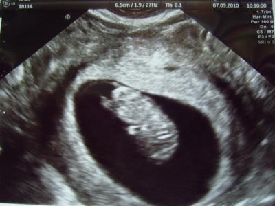 Bild zu @kaka_b und gerne auch alle anderen Mamis ;-) - Forum für April - Mamis