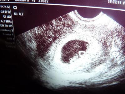 Bild zu endlich - Forum für April - Mamis