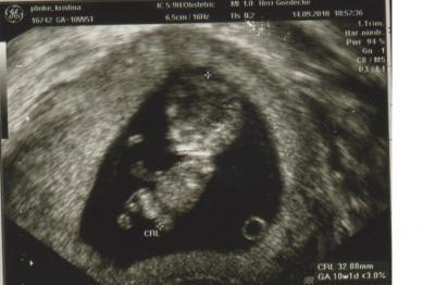 Bild zu Babybild!!!! 10+5 - Forum für April - Mamis