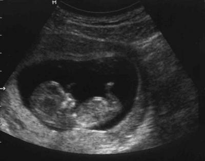 Bild zu US-Bild - Forum für April - Mamis