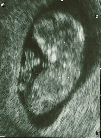 Bild zu -Babykino- - Forum für April - Mamis
